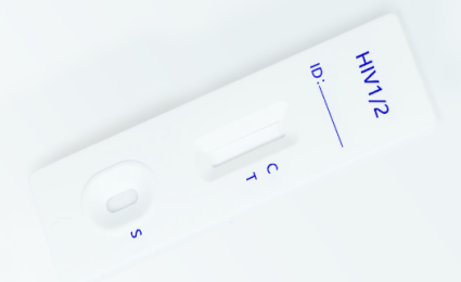آنتی بادی ها به HIV Type 1 نوع 2 کاست تست سریع تست سریع
